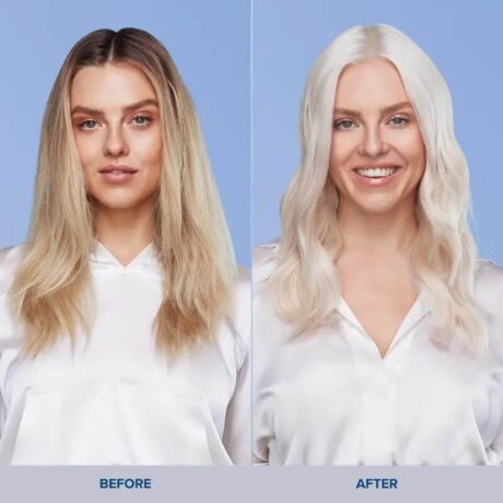 Bond-rx-before-after2